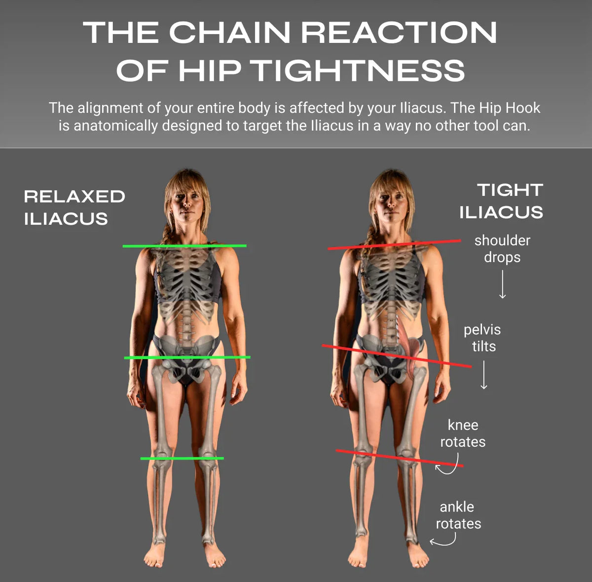 Diagram showing the chain reaction of hip tightness with anatomical illustrations and text.