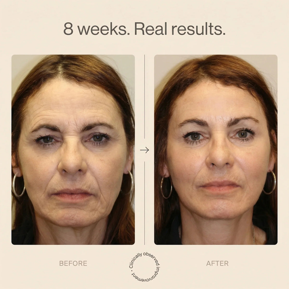 Before and after comparison of a woman's face with text '8 weeks. Real results.'
